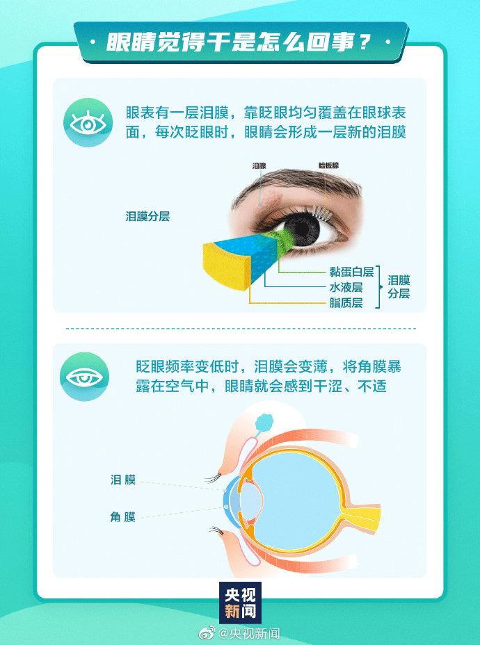 经常眼干怎么办？ 快来了解正确的护眼知识