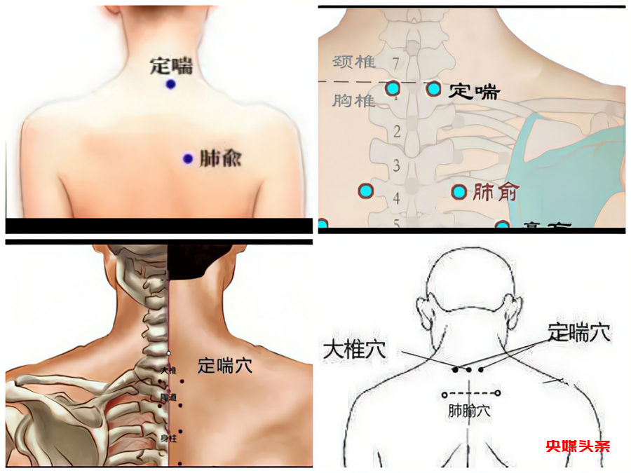 周文程守正创新 特色中医疗法 ——简单实用 疗效立竿见影